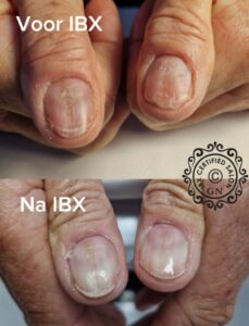 ibx zevenaar